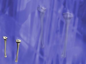 Tibia (Shankbone) Title Content PowerPoint Template