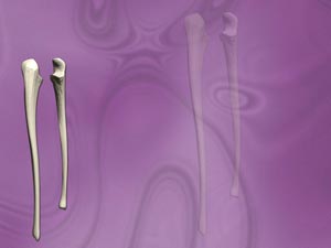 Ulna (Forearm Bone) Title Content PowerPoint Template