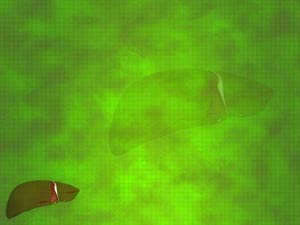 Falciform Ligament Title Content PowerPoint Template